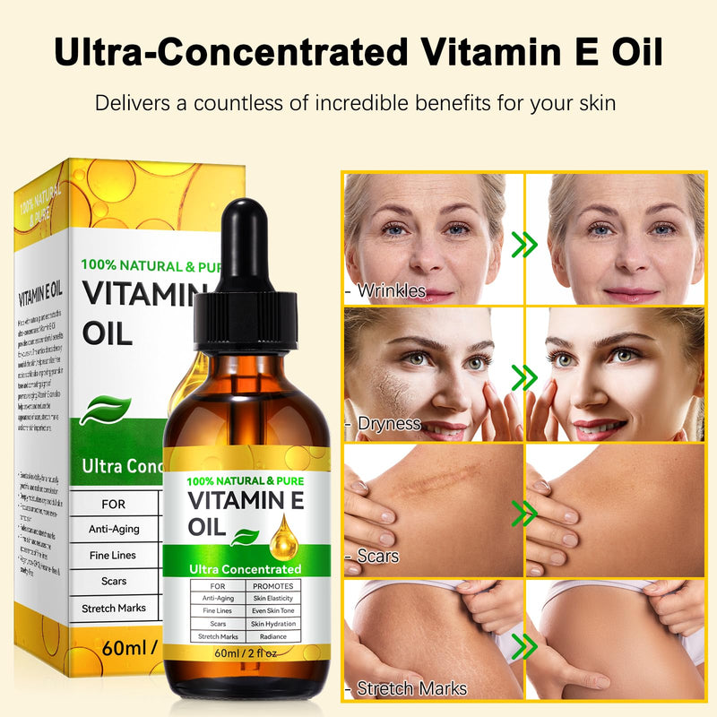 Vitamin E Oil for Skin 75,000 IU – 2 Pack Organic Vitamin E Oil for Face, Hair, Scars, Nails, Ultra-Hydrating Body Oil for Dry Skin Wrinkles,Cold-Pressed, Non-GMO, Organic Skincare Formula –2 Fl Oz 2.02 Fl Oz (Pack of 2)