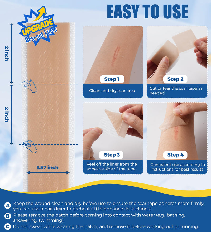MasterMo Medical Grade Silicone Scar Sheets & Tape - Ultra Soft, Hypoallergenic Rolls (1.6‚Äùx60" Roll) for Surgical, C-Section, Tummy Tuck, Keloid Scars, Stretch Marks & Burn Scar Removal 1.5M - BeesActive Australia