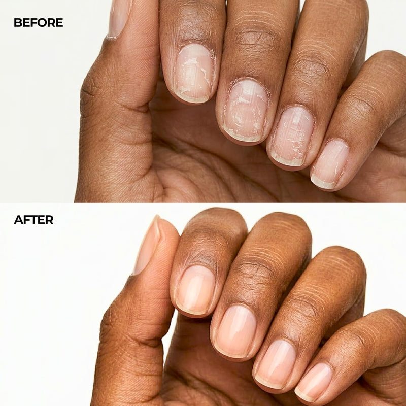 Fast-Absorbing Nail Strengthener for Weak, Thin & Post-Acrylic Damaged Nails - Perfect for Frequent Handwashing - Niacinamide, Keratin, Hyaluronic Acid & Peptides - 45 Day Supply by nakeyNails