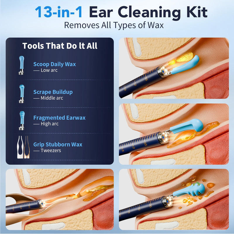Ear Wax Removal, Ear Cleaner with Camera 1296P HD,Visual Ear Cleaner with 6 LED Lights and Flexible Tip,FSA HSA Eligible Items,Safe Ear Wax Removal Kit with Camera,Ear Cleaning Tool for Family Gifts Black - BeesActive Australia