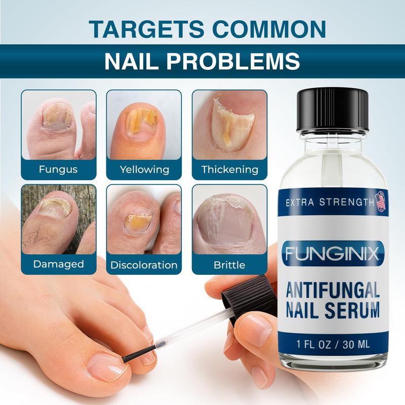 FUNGINIX Toenail Fungus Treatment Extra Strength - Antifungal Nail Treatment With 10% Undecylenic Acid & Tea Tree Oil - Includes Natural Oils & Botanicals - Made in USA (Packaging Does Vary) 1 Fl Oz (Pack of 1)