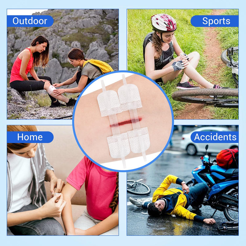 34 Pack Wound Closure Strips, Zip Stitches Wound Closure Kit 6PCS Repair Wounds Without Stitches, Sutures Butterfly Bandaids for Cut Care, Skin Closures, Outdoor Survival, Trauma Care