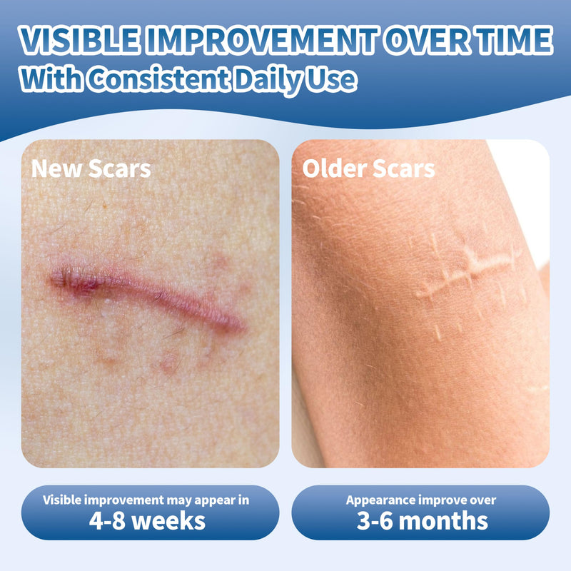 50g Silicone Scar Cream, Advanced Scar Gel for Old & New Scars, Scar Treatment Cream for Surgical Scars, Stretch Mark, Burns & Acne Treatment for Face & Body 50g - BeesActive Australia