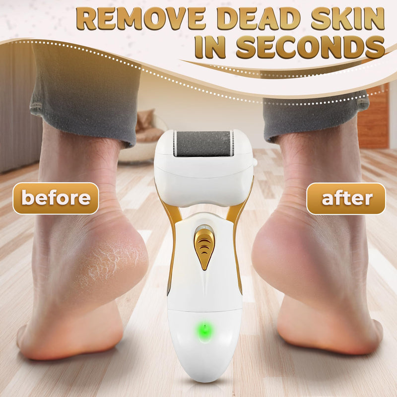 Electric Callus Remover for Feet – Electric Foot Filer with 3 Replacement Rollers & 360° Rotating Head – Hard Skin Remover for Feet with Ergonomic Handle for Easy Grip & Control in Home Pedicure Gold Callus Remover - BeesActive Australia