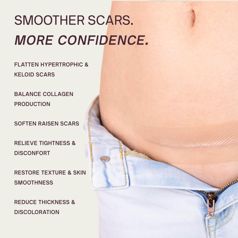 Dermaclara C-Section Scar Patch - Pregnancy Stretch Mark Prevention & Removal, C Section Cover Up Belly Scar Sheet, Maternity Skincare, Mom to Be Silicone Gel Pad, Reusable up to 30 Times - 1 Patch