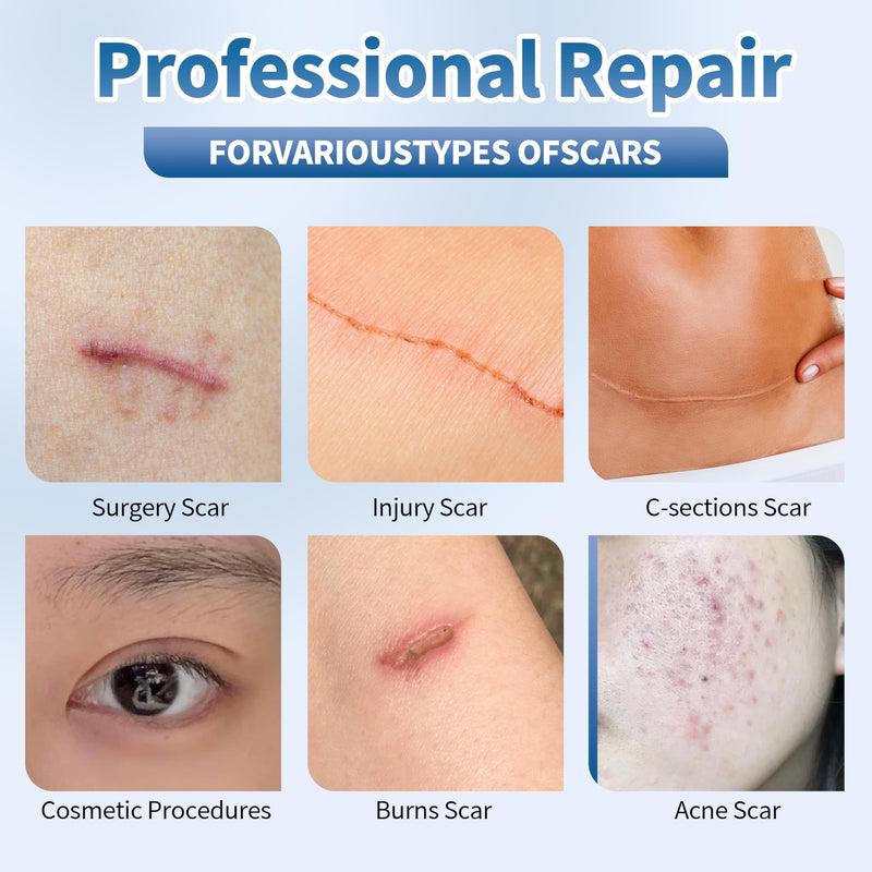 50g Silicone Scar Cream, Advanced Scar Gel for Old & New Scars, Scar Treatment Cream for Surgical Scars, Stretch Mark, Burns & Acne Treatment for Face & Body 50g - BeesActive Australia
