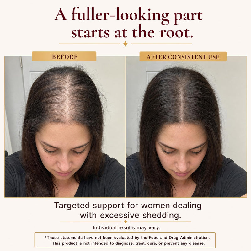 Ferritin Iron Supplement for Women - Hair Growth, Vitamin C, Vegan | 100mg Ferrochel iron, zinc, biotin, vitamin C. Phase 1 of a two-phase system for women with low ferritin. Vegan, 30 ct.