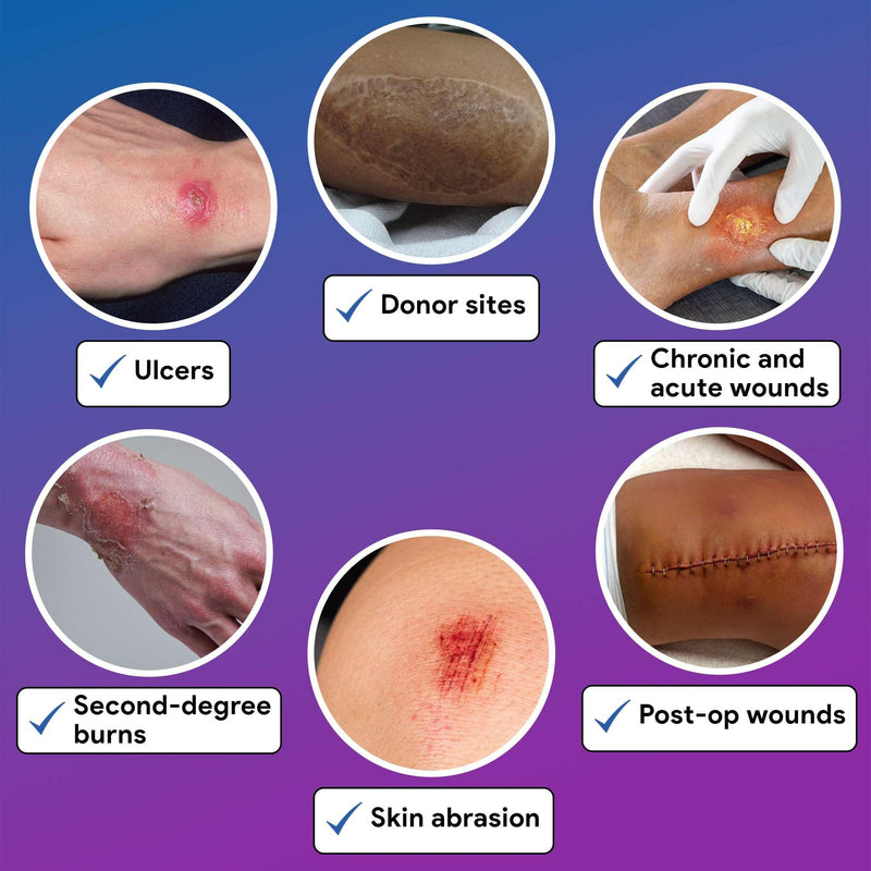 Bordered Foam Silver Dressings for Wound Care 6"x6" - 10 Ag Foam Dressings for Moderate to Heavy Wound Exudate - Highly Absorbent and Water Resistant 6"x6"