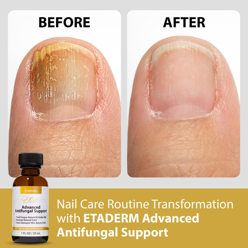 Nail Care & Repair Formula - Advanced Nail Repair for Damaged Nails Supported by Growth Oil and Enriching Serum - Promotes Polished Finish, Smooth Texture and Strengthened Nails Appearance 1 Fl Oz (Pack of 1) 1.0