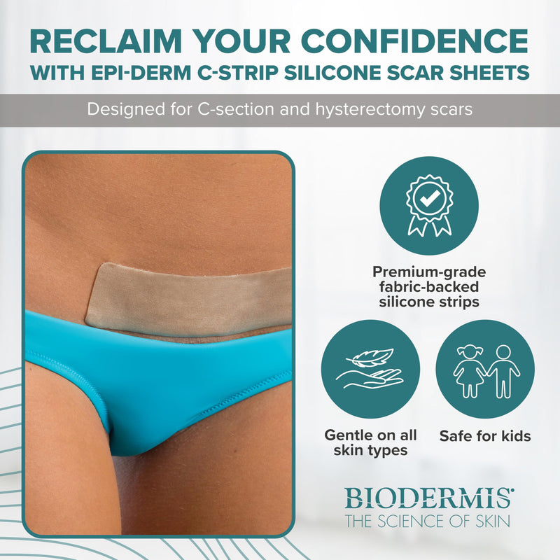Epiderm Silicone Gel Scar Sheets - Premium-Grade Silicone Scar Sheets for Optimal Scar Care - Versatile, Flexible & Reusable - Ideal for C-Section, Tummy Tuck & Hysterectomy Scars - 1.4x6 in, Natural 1.4x6 Inch (Pack of 1) - BeesActive Australia