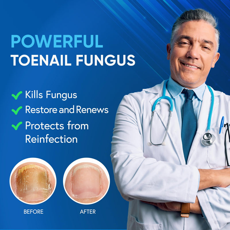 Toenail Fungus Treatment For Toenail & Finernails, 25% Undecylenic acid, Toe Nail Fungus Treatment Extra Strength, Tea Tree Oil for Tonail Fungus Treatment