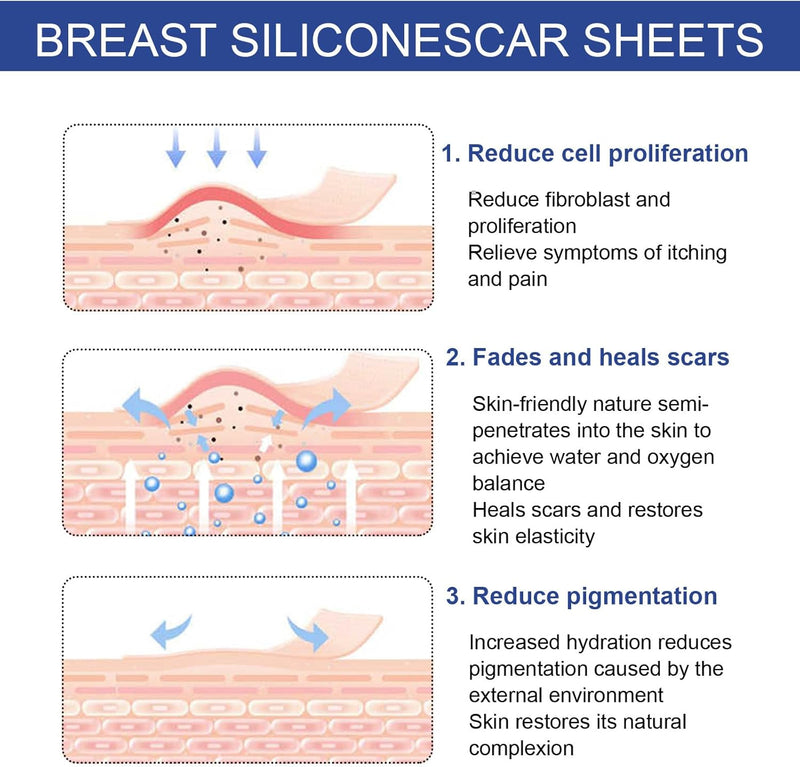 Silicone Scar Sheets for Breast - 8 Pack, Including 4 Areola Soft Strips & 4 Anchor Sheets