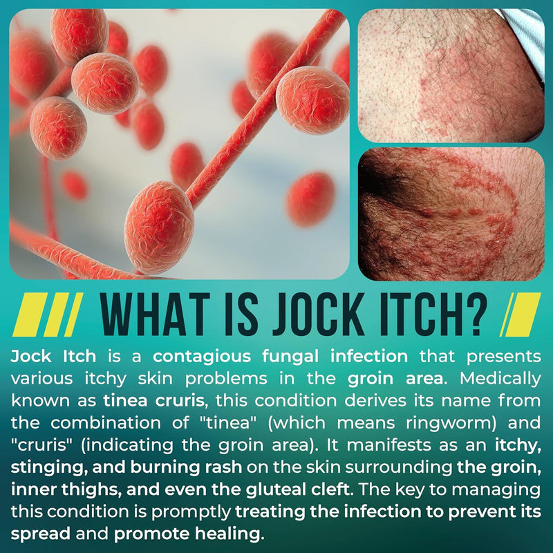 Jock Itch Cream | Extra Strength Antifungal Treatment for Groin & Inner Thighs | Relief for Itchy Skin, Jock Itch, Ringworm, Athlete’s Foot & Nail Fungus | Controls Odor & Removes Fungus | 120ml - BeesActive Australia
