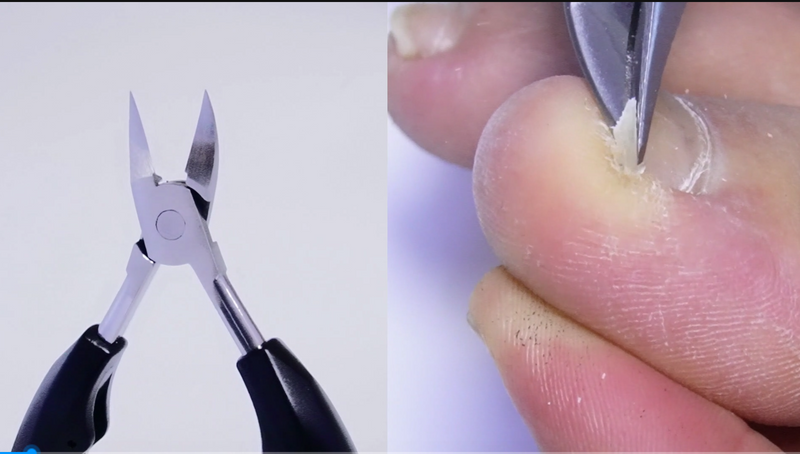 Ingrown Toenail Clipper Thick Nails Cutter Toe Nails Removal Kit Pedicure Tools for Feet Trimmer for Men Women Senior A-5