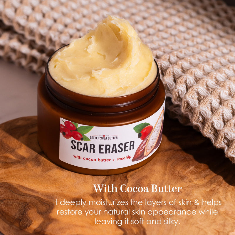 Better Shea Butter Scar Eraser Balm - Cocoa Butter Cream for Stretch Marks and Dark Spots, Burns, Old Scars - Acne Scars - Designed w Zero Synthetic Ingredients, 4 oz - BeesActive Australia