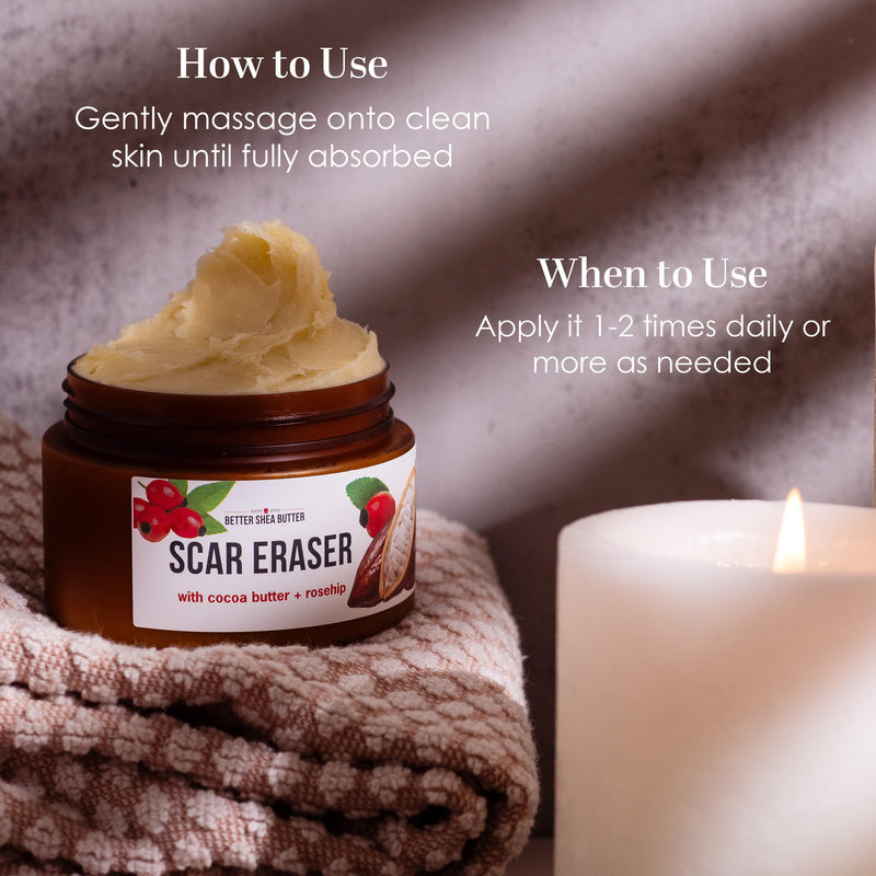 Better Shea Butter Scar Eraser Balm - Cocoa Butter Cream for Stretch Marks and Dark Spots, Burns, Old Scars - Acne Scars - Designed w Zero Synthetic Ingredients, 4 oz - BeesActive Australia