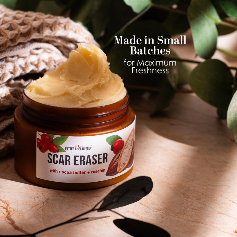 Better Shea Butter Scar Eraser Balm - Cocoa Butter Cream for Stretch Marks and Dark Spots, Burns, Old Scars - Acne Scars - Designed w Zero Synthetic Ingredients, 4 oz - BeesActive Australia