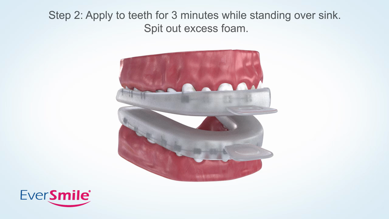 EverSmile OrthoFoam Braces Cleaner — Brushable Foam Whitens Teeth, Eliminates Bacteria, Fights Plaque and Bad Breath – Cleans Under Metal, Ceramic, Clear Brackets and Wires – 50ml (2 Pk)