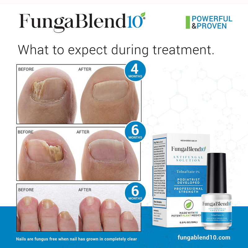 FungaBlend 10 - Antifungal Medication:1% Tolnaftate and 10 Plant Medicines -Toenail Fungus Treatment for Nail Repair Gel, Athletes Foot, Jock Itch, Ringworm -Topical Solution for Toe and Finger Nail - BeesActive Australia