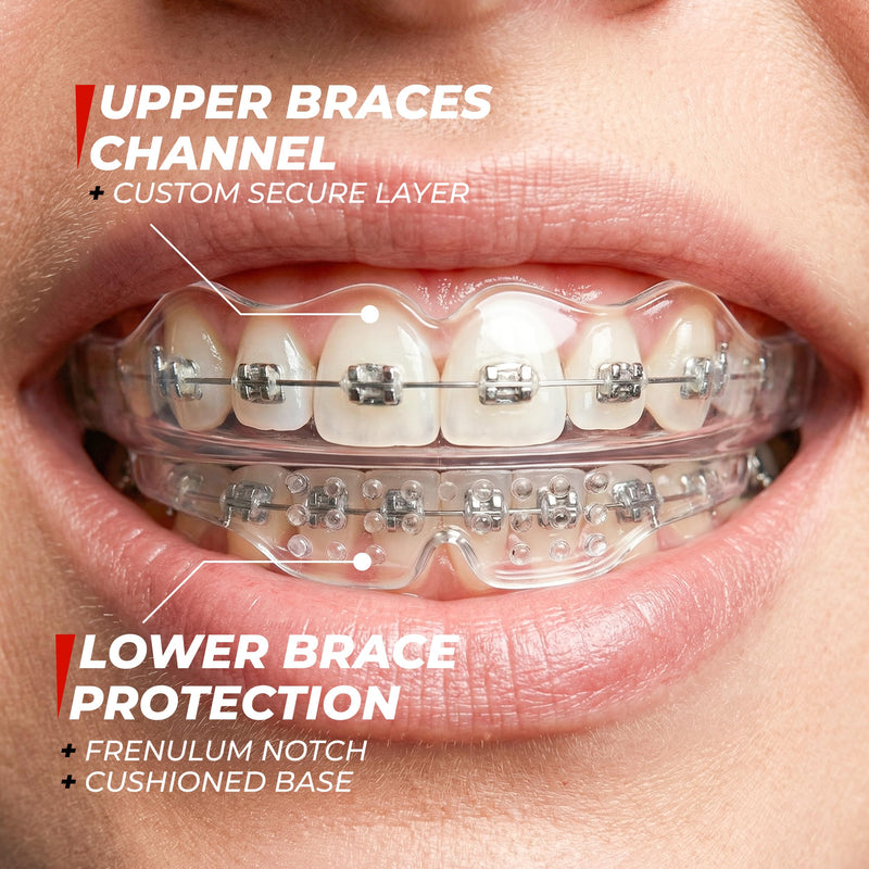 Mouth Guard for Sports - Premium Silicone Upper & Lower Teeth Protection - Football, Lacrosse, Hockey, Baseball - Fit for Youth and Teens (Transparent, MouthGuard for Braces) Transparent - BeesActive Australia