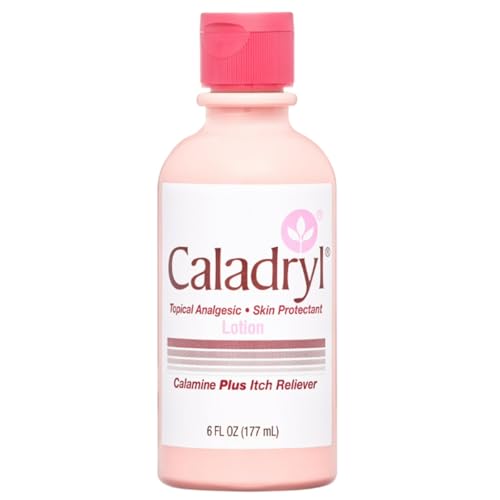 Caladryl Calamine Lotion for Itching, Insect Bites & Poison Ivy, 6 Fl Oz 6 Fluid Ounces 1
