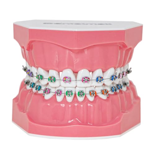 Typodonts Orthodontics Demonstration Model with Metal Wires and Bracket Teaching, Learning, Interpretation Model for Adults and Children (Metal Bracket) 7010-2