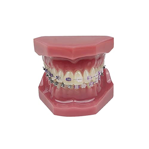 Orthodontic Model, YOUYA DENTAL 1/4 Metal self-Locking Comparison Orthodontic Model Orthodontic Tooth Model Dental Teaching Teeth Model with Metal Braces Bracket for Dentist Teaching Tools to Display 1/4 Metal self-Locking Model