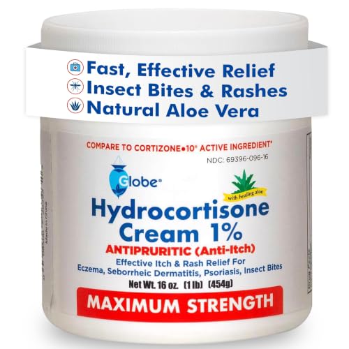 Globe Hydrocortisone Cream 1% with Aloe, Maximum Strength, 16 oz Jar 16 Ounce