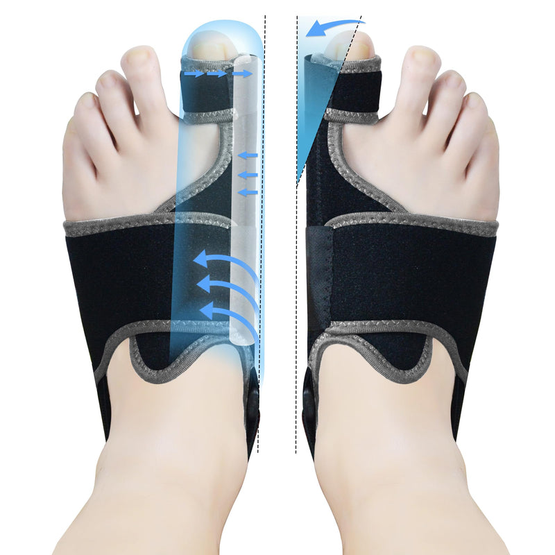 MOONSMILE Foot Gear 1 Pair Bunion Corrector for Women & Men, Night Bunion Splint, Big Toe Straightener, Foot Gear Brace for Bunion Pain Relief Black/Grey One Size