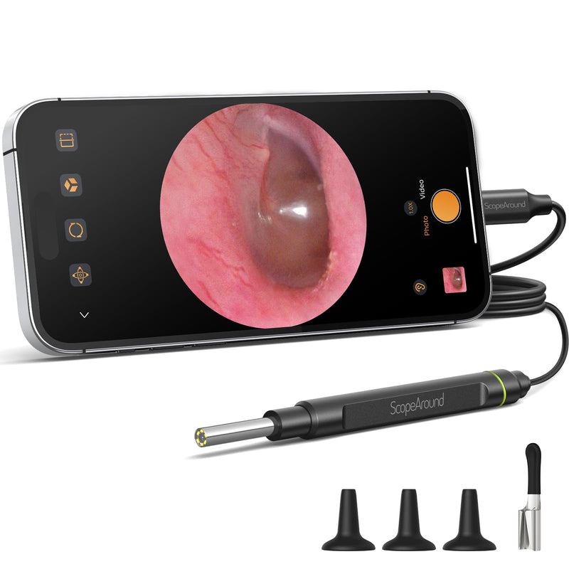 ScopeAround Otoscope with Light, 1080P FHD Ear Scope, 3.9mm Digital Otoscope Camera with 6 LED Lights Ear Wax Removal Tool Camera, Ear Scope with Light, Compatible with USB-C - BeesActive Australia