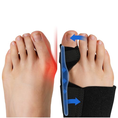 Fittest Pro Bunion Corrector (2pcs), Orthopedic Bunion Splint, Big Toe Separator Pain Relief, Non-Surgical Hallux Valgus Correction, Hammer Toe Straightener, Day Night Support
