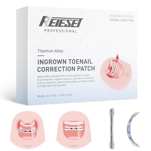Titanium Alloy Ingrown Toenail Treatment, NailTools, and Ingrown Toenail Removal Kit SpeciallyDesigned for Curved Nail Repair and Ingrown ToenailCorrector (0.59/0.67in) 0.59/0.67in