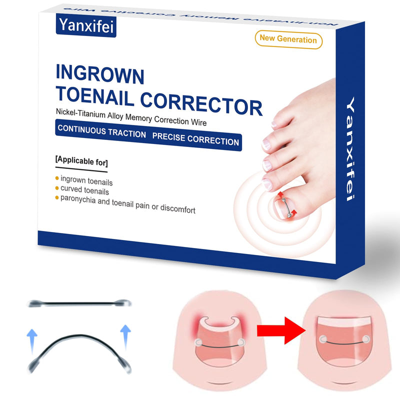 Nitinol Ingrown Toenail Corrector,at Home Ingrown Toenail Treatment,Curved Toenail Straightener,Ingrown Toe Nail Relief，Ingrown Toenail Removal Kit (1/2 In,11/16 In) 1/2 In,11/16 In