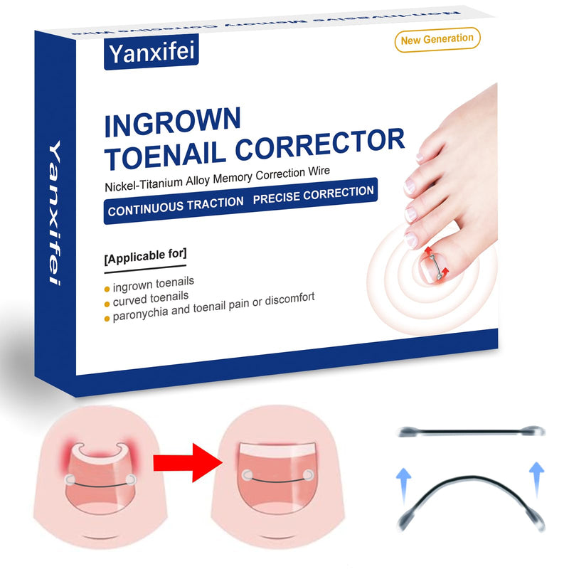 Nitinol Ingrown Toenail Corrector,at Home Ingrown Toenail Treatment,Curved Toenail Straightener,Ingrown Toe Nail Relief，Ingrown Toenail Removal Kit (11/16 In,13/16 In) 11/16 In,13/16 In