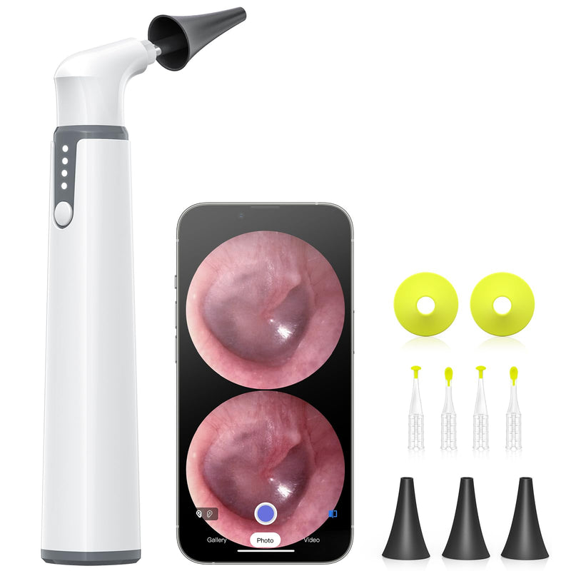 Wireless Otoscope with Gyroscope, Ear Camera with Dual View, 3.9 mm Otoscope with Light, Ear Scope with Ear Wax Removal Tool for Kids, Adults, and Pets, Compatible with iPhone and Android - BeesActive Australia