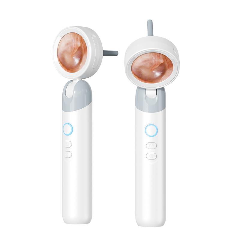 Smart Ear Camera with Screen, 2MP HD Otoscope, 90° Rotating Head, 1.38" Display, 12 Specula Tips, Photo & Video Function - BeesActive Australia