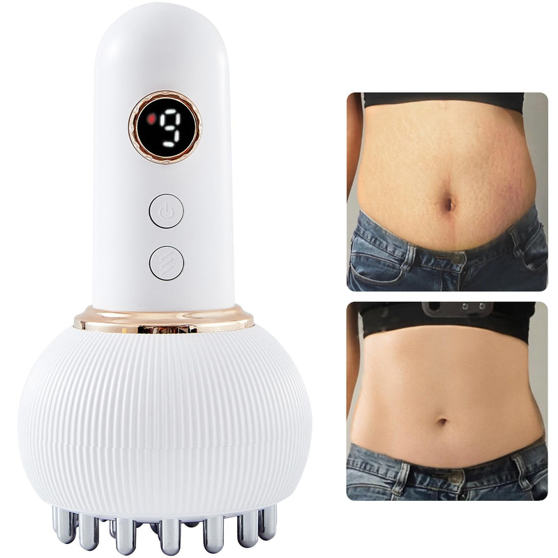 Lymphatic Drainage Massager & Anti Cellulite Massage Tool, Helps Reduce Stretch Marks & Cellulite, for Legs, Arms & Belly, Body Sculpting Machine with Microcurrent, Light, Heat & Vibration White