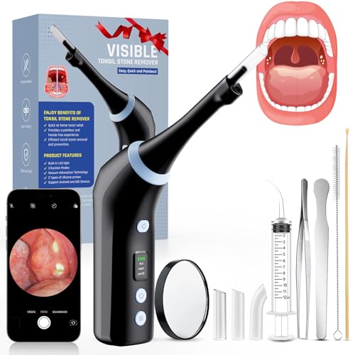 Electronic Tonsil Stone Remover with Camera, Tonsil Stone Removal Kit, 3 Suction Levels, Tonsil Stone Vacuum, Oral Care for Mouth Health, USB Rechargeable (Black)