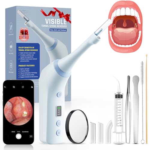 Electronic Tonsil Stone Remover with Camera, Tonsil Stone Removal Kit, 3 Suction Levels, Tonsil Stone Vacuum, Oral Care for Mouth Health, USB Rechargeable(Blue)