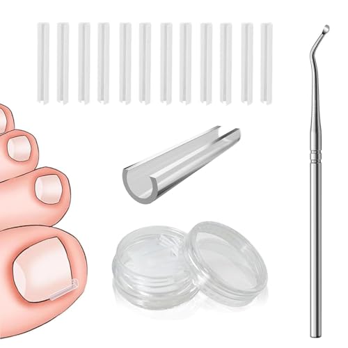 50 Pcs Ingrown Toenail Corrector Set, Toenail Correction Strips Brace Kit, Ingrown Toenails Correction Pad Recover Clips, Toenails Straightener Strips for Women Men's Nail Treatment Pedicure