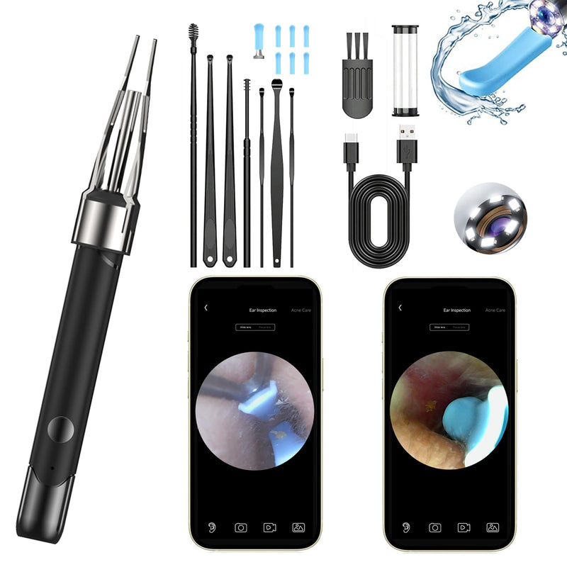 Ear Wax Removal Tool Camera | 2-in-1 Scoop & Tweezer, 5.0MP HD Otoscope | FDA-Registered WiFi Ear Cleaner with 6 LED Lights, Complete Kit for iPhone & Android - BeesActive Australia