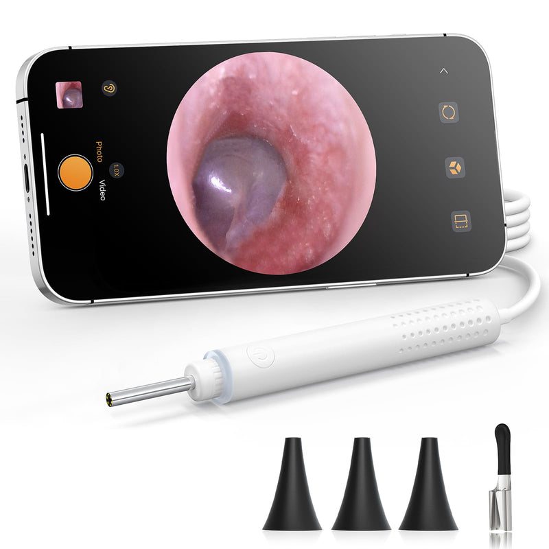 ScopeAround Otoscope with Light, 720P HD Ear Cleaning Camera & 6 LED Lights Ear Scope, Digital Otoscope with Camera, Smart Endoscope, Plug & Play, USB-C Port - BeesActive Australia