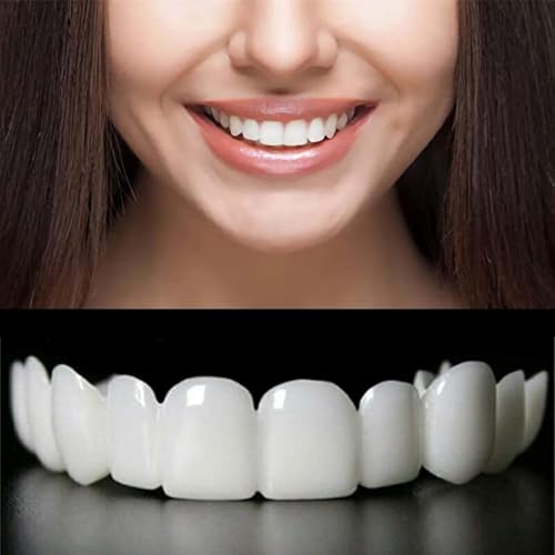 Adjustable Smile Supports - 2 Pairs (Top & Bottom) | Comfortable & Secure Fit