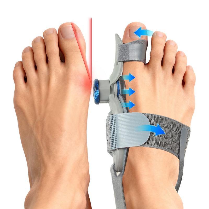 Bunion Corrector for Women & Men Big Toe, Upgraded Big Toe Straightener Bunion Fix with Adjustable Knob, Separator Reliefer with Soft Gel Pad for Left/Right Feet (Gray 1Pcs) Gray1 - BeesActive Australia