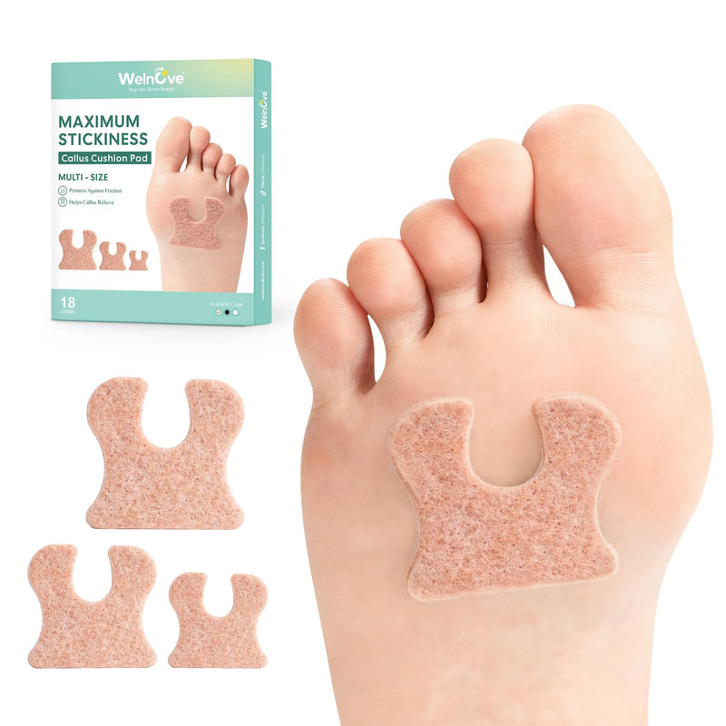 Welnove U-Shaped Felt Callus Pads, 18-Pc Pack – Self-Adhesive Cushions to Prevent Rubbing & Relieve Pain Multi-size (Pack of 18) Beige - BeesActive Australia