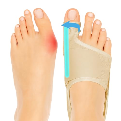 SPRING SEAON 2-Pack Bunion Corrector Adjustable Toe Splint Day/Night Beige