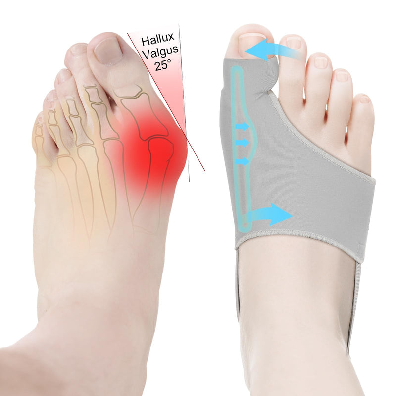 2PCS Bunion Corrector for Women & Men Big Toe Straightener - Bunions Correction Tool for - Bunion Splint with Soft Pads - Hallux Valgus Pain Relief, Breathable Fabric for Day & Night Wear (1, Gray) 1 - BeesActive Australia