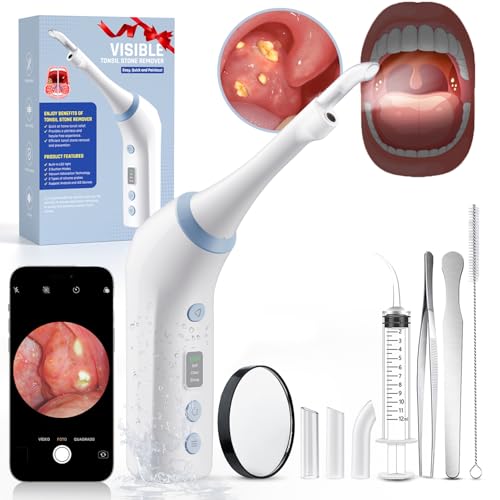 2026 Upgraded Electric Tonsil Stone Remover with 1080P Camera，Tonsil Stone Removal Kit with LED Light，900mAh Tonsil Stone Vacuum – Oral Care for Mouth Health & Painless Cleaning