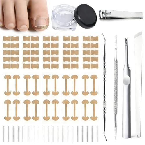 Ingrown Toenail Corrector Kit - Professional Painless Correction Strips & Pedicure Tools for At-Home Care