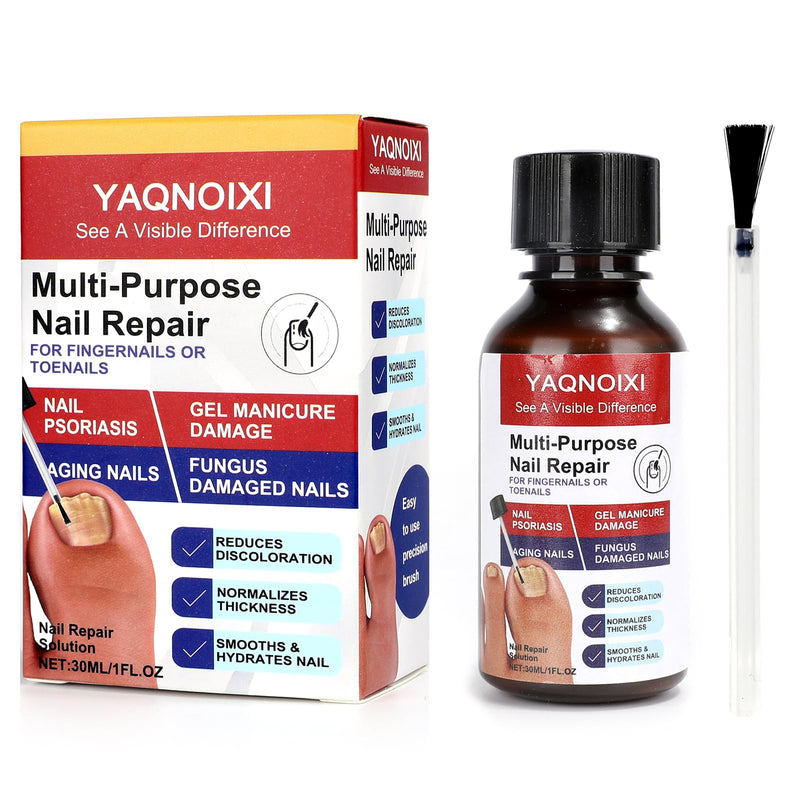 Toenail Fungus Treatment - Fast Acting For Thick, Discolored, Broken & Damaged Toe & Finger Nail, Treats Damaged Nails and Ingrown Toenails - 30ml/1oz (1pcs) 1pcs